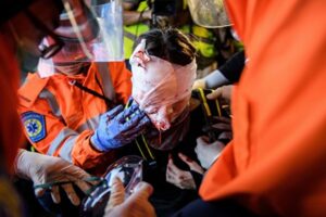 【写真】香港市民の抗議10週目、警察隊の武力行使で血だらけの若者　衝突が激化