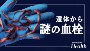 5～7割の遺体から謎の血栓が【フロントライン・ヘルス】