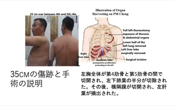 証言が明かす弾圧の現実　法輪功学習者たちの声　東京で響く