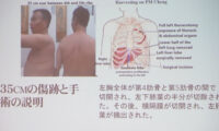 証言が明かす弾圧の現実　法輪功学習者たちの声　東京で響く