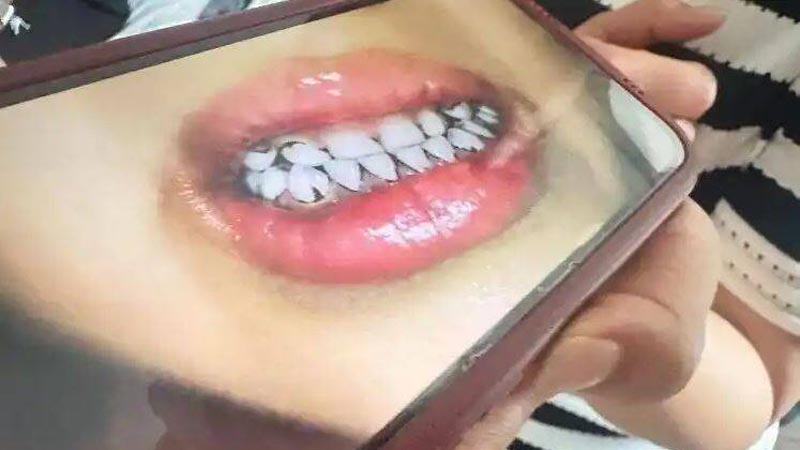 中国の幼稚園で230人超が鉛中毒　現地の鉛汚染の闇に疑惑噴出【動画あり】