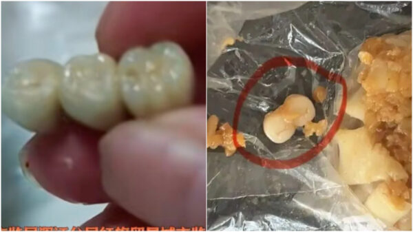 人の歯入りソーセージ　人の歯入りシュウマイ　「遺体再利用」の噂は本当だった？＝中国【動画あり】