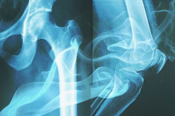 あなたの骨は「吸ったタバコ」を記憶している