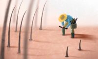 毛髪移植で後悔しないために——知っておくべき5つの事実