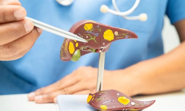 脂肪肝は心臓病の危険因子　肝と心臓を守る方法