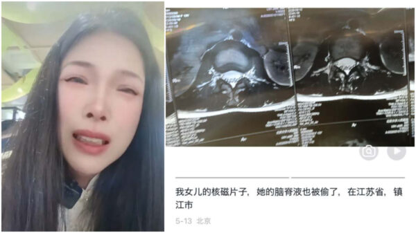 「脳脊髄液を病院に盗まれた」　中国の母親が涙の告発